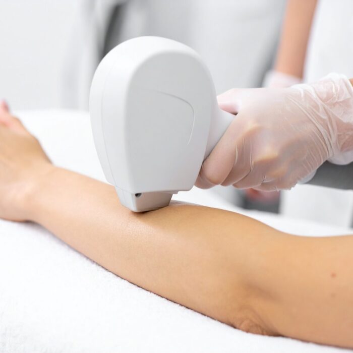 A cosmetic procedure utilizing laser hair removal on an arm. The arm rests on a white surface while being treated with a depilation device
